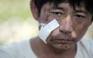 An injured man rests near the explosion site in Binhai new district in Tianjin, China August 13, 2015. Two huge explosions tore through an industrial area where toxic chemicals and gas were stored in the northeast Chinese port city of Tianjin, killing at least 44 people, including at least a dozen fire fighters, officials and state media said on Thursday. REUTERS/Damir Sagolj