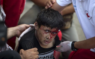 ATTENTION EDITORS - VISUAL COVERAGE OF SCENES OF INJURY OR DEATHA migrant boy reacts after he was shocked by electricity, while trying to climb a utility pole, at Gevgelija train station in Macedonia, close to the border with Greece, August 14, 2015. In the past month, an estimated 30,000 refugees have passed through Macedonia, another step in their uncertain search for a better life in western Europe.  REUTERS/Stoyan Nenov       TPX IMAGES OF THE DAY