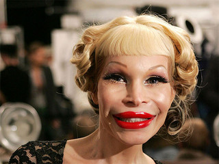 plastic_surgery_fails_1