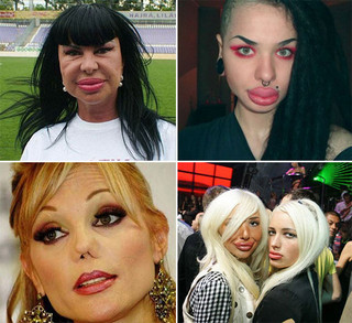 plastic_surgery_fails_15