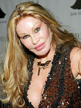 plastic_surgery_fails_16