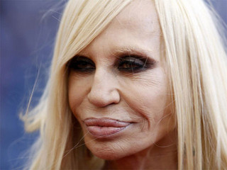 plastic_surgery_fails_5