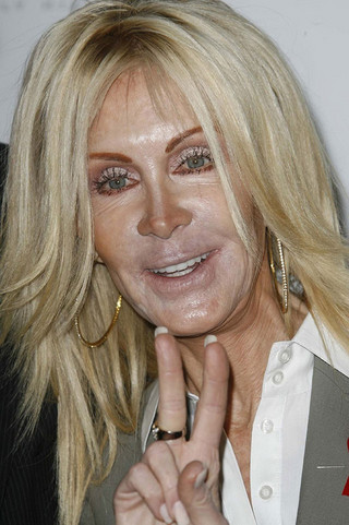 plastic_surgery_fails_7