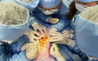 Έξι παράξενα πράγματα που συνέβησαν μετά από εγχειρήσεις