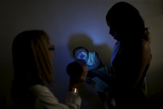 Πρώτος θάνατος βρέφους από μικροκεφαλία λόγω Ζίκα στην Αργεντινή