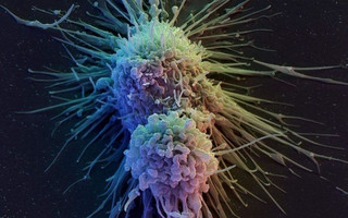Τη θεραπεία για τον καρκίνο ισχυρίζονται ότι βρήκαν επιστήμονες