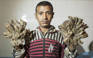 treeman1