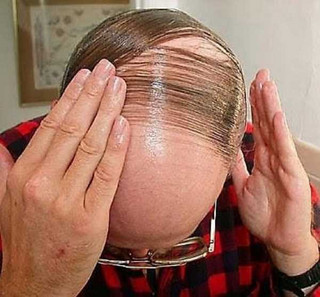 bald-men-17