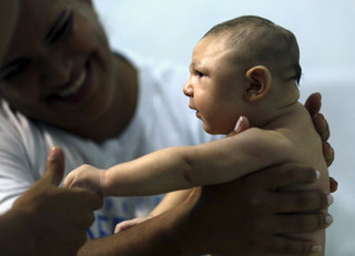 Πρώτο κρούσμα μικροκεφαλίας εμβρύου στο Πουέρτο Ρίκο