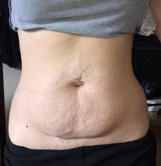 takebackpostpartum2