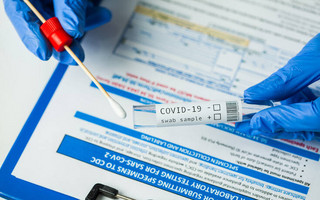 Βασίλης Κοντοζαμάνης: Τα PCR test για τον κορονοϊό αυξήθηκαν κατά 84% τον Φεβρουάριο