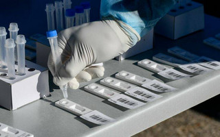 Κικίλιας: Υποχρεωτικά τα rapid test στους ανεμβολίαστους υγειονομικούς του ΕΣΥ