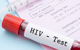 AIDS: Και δεύτερος ασθενής φαίνεται να απαλλάχτηκε τελείως από τον ιό HIV με φυσικό τρόπο