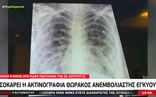 Αγωνία για 10 γυναίκες στο Ιπποκράτειο που γέννησαν πρόωρα λόγω κορονοϊού Αγωνία για 10 γυναίκες στο Ιπποκράτειο που γέννησαν πρόωρα λόγω κορονοϊού