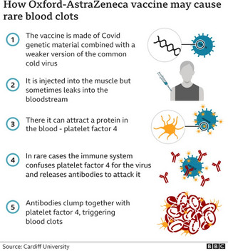 Γράφημα που εξηγεί τη δημιουργία θρόμβων μετά τον εμβολιασμό με AstraZeneca