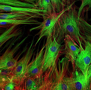 fibroblasts κύτταρα fibroblasts κύτταρα