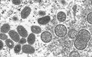 Ευλογιά των πιθήκων: Αυξημένη επαγρύπνηση ζητά ο Μαγιορκίνης – Τι γνωρίζουμε για την εξάπλωση του ιού