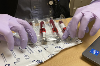 Βρετανία: Επικεφαλής δημόσιας έρευνας για σκάνδαλο μολυσμένου αίματος ζητεί να δοθούν αποζημιώσεις στα θύματα