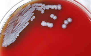 Μελιοείδωση: Βακτήρια που προκαλούν τη σπάνια αλλά θανατηφόρα ασθένεια βρέθηκαν στον Μισισιπή
