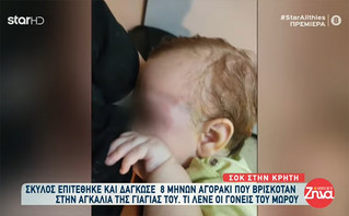 Συγκλονίζει η μητέρα του 8 μηνών βρέφους που δέχτηκε επίθεση από λυκόσκυλο: «Δεν ήξερα εάν είχε μάτι»