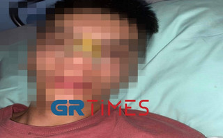 Θεσσαλονίκη: Τρεις ανήλικοι ξυλοκόπησαν άγρια 14χρονο