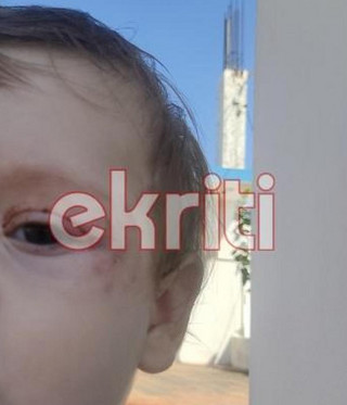 Εικόνες - σοκ από την επίθεση του σκύλου στο βρέφος Εικόνες - σοκ από την επίθεση του σκύλου στο βρέφος