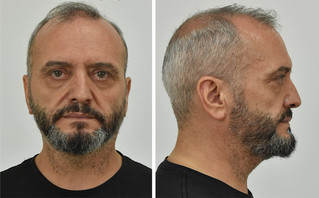 Κολωνός Κολωνός