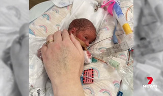 Το «μωρό θαύμα» που γεννήθηκε πρόωρα με έναν όγκο διπλάσιο από το μέγεθός του