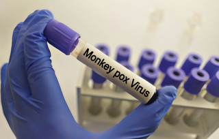ευλογιά πιθήκων mpox ευλογιά πιθήκων mpox