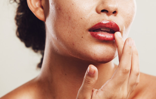 5 lip balms από τα Sephora που θα φοράτε όλη μέρα | Woman στο PlusTV.gr