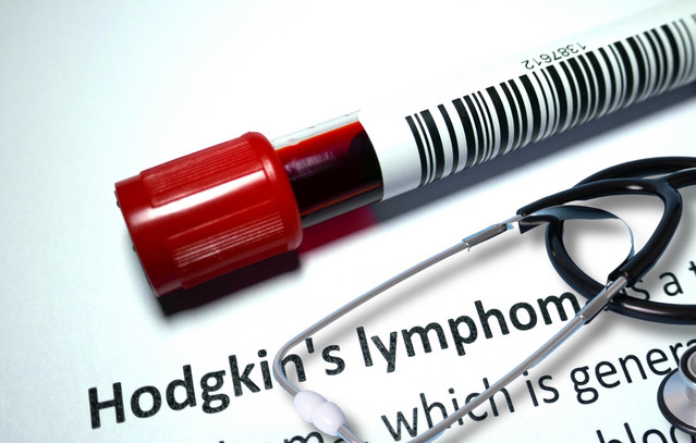 Νίκη απέναντι στο λέμφωμα Hodgkin: Νέα θεραπευτική επιλογή για ασθενείς σε όλη την Ευρώπη | Υγεία στο LivePress.gr