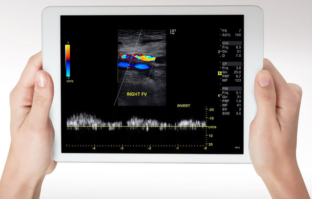Καρκίνος: Νέα υπερηχογραφική τομογραφία εντοπίζει όγκους με μεγαλύτερη ακρίβεια, χωρίς ακτινοβολία και χωρίς σκιαγραφικό