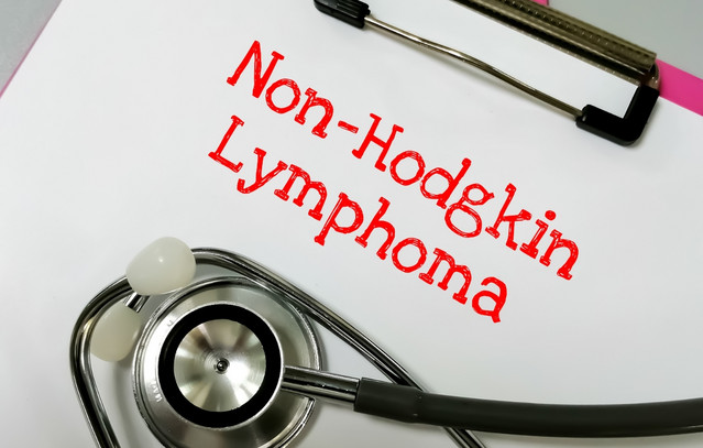 Μη-Hodgkin λέμφωμα: Η μάχη που σήμερα κερδίζεται όλο και συχνότερα – Οι νέες θεραπείες αλλάζουν τις προοπτικές ζωής χιλιάδων ασθενών