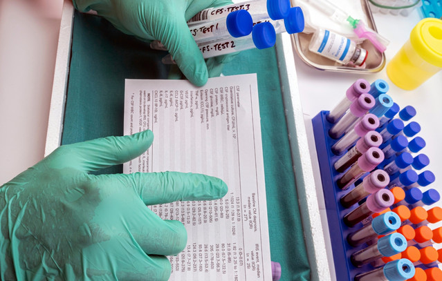 Στρατηγικό άλμα για την Angelini Pharma – Ολοκληρώνει την εξαγορά της Catalyst και ισχυροποιείται στην παγκόσμια αγορά