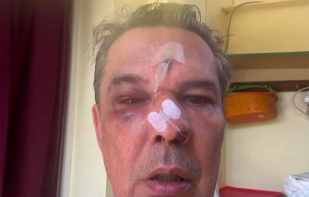 Ξυλοδαρμός σε ιατρείο στο Χαϊδάρι – Του μαύρισε το μάτι και τον έστειλε στο νοσοκομείο για ασήμαντη αφορμή