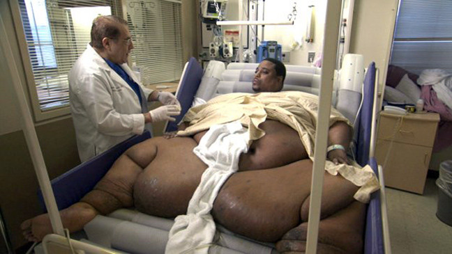 Οι πιο παχύσαρκοι άνθρωποι του κόσμου