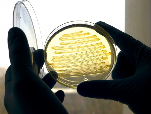 Βακτήρια E.coli σε ρόλο&#8230; διυλιστηρίου