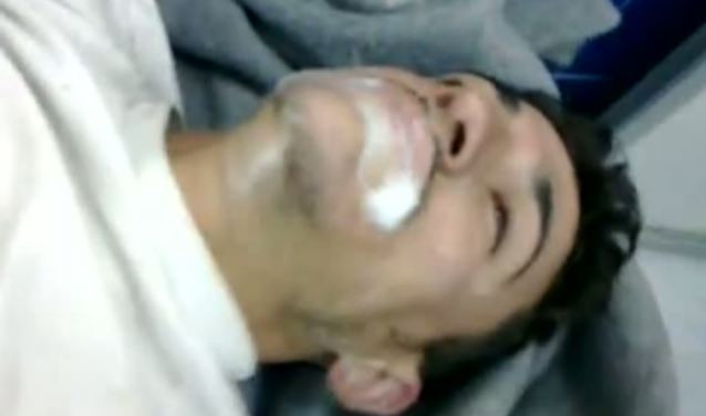 Σύροι νοσηλεύονται με αναπνευστικά προβλήματα και αφρούς στο στόμα