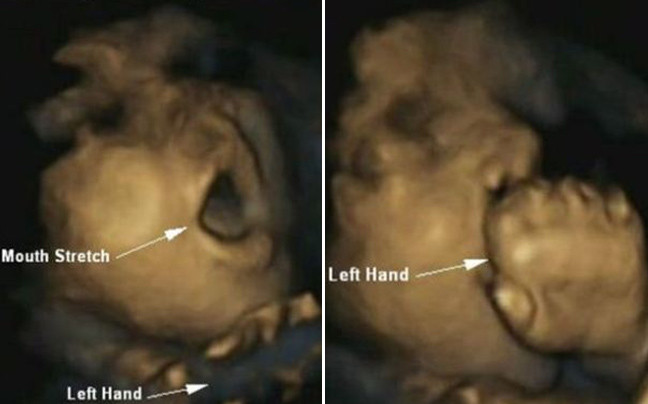 Το άγγιγμα του προσώπου αποτελεί ένδειξη υγείας του εμβρύου
