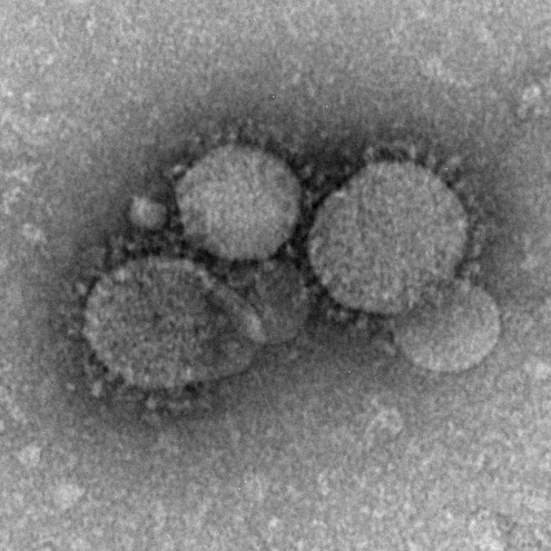 Φυσικά ανθρώπινα αντισώματα κατά του ιού MERS