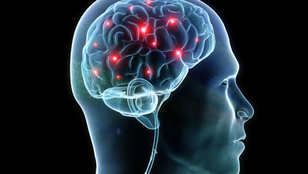 Νέο βιοδείκτη για διάγνωση εγκεφαλικών όγκων αναπτύσσουν Έλληνες ερευνητές