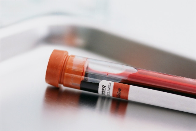 Τεστ αίματος για τη διάγνωση του καρκίνου του προστάτη
