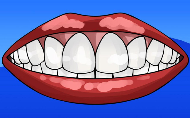 Τι δεν ξέρουμε για τα δόντια