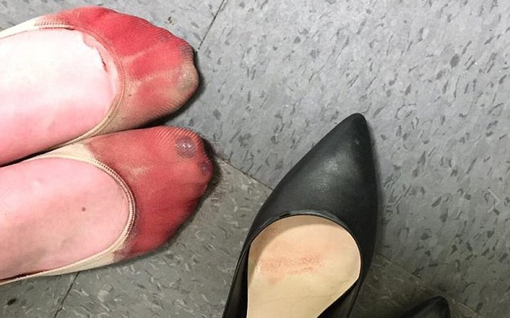 Τα ματωμένα πόδια μιας σερβιτόρας που καλείται να φορέσει τακούνια στη δουλειά