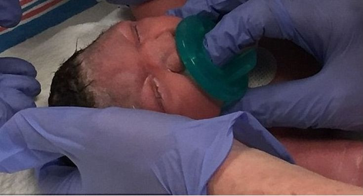 Μωρό με μικροκεφαλία λόγω του ιού Ζίκα γεννήθηκε στο Νιου Τζέρσι