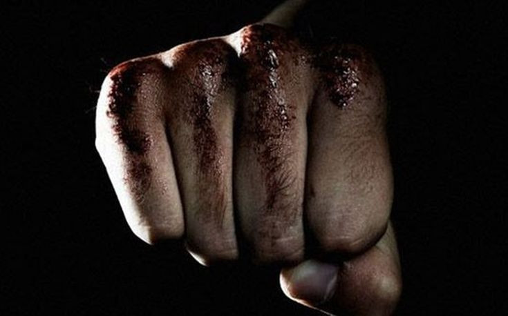 Μαχαιρώματα και άγριο ξύλο στη Λαμία: Τον χαράκωσε στο πρόσωπο και τη χτύπησε με μπουνιές και κλωτσιές
