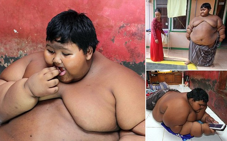 Το πιο παχύσαρκο παιδί στον κόσμο ζυγίζει 192 κιλά σε ηλικία 10 ετών