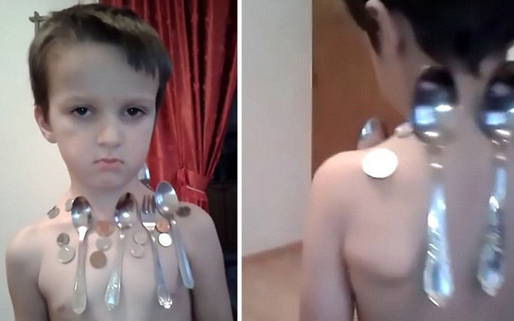 Το 5χρονο αγόρι &#8211; «μαγνήτης» από τη Βοσνία Ερζεγοβίνη