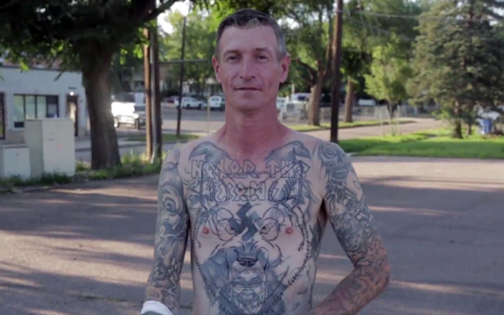 Νεοναζί αφαίρεσε τα ρατσιστικά τατουάζ του εξαιτίας μιας απροσδόκητης φιλίας