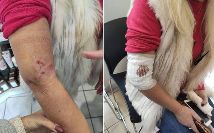 Λαμία: Σκύλος επιτέθηκε και δάγκωσε γυναίκα